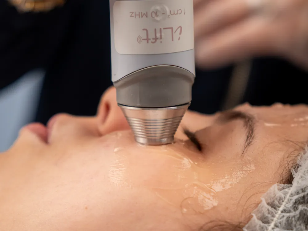 iLift em procedimento facial