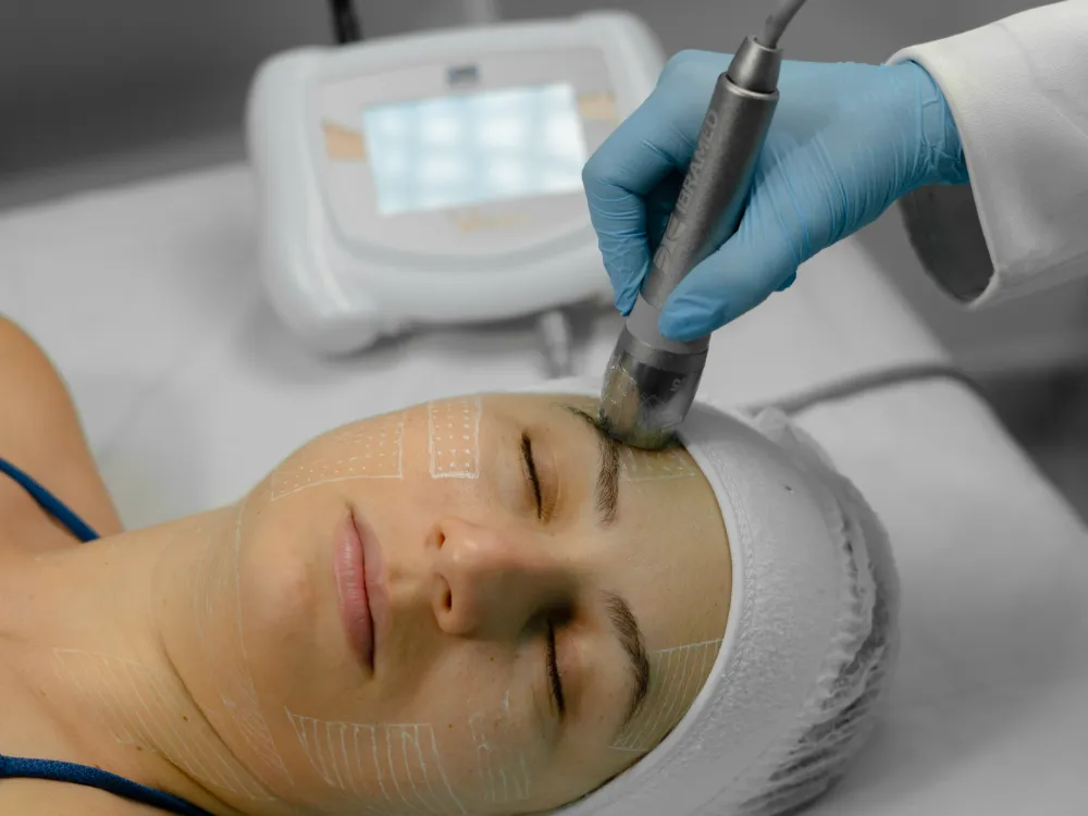Ponteira em procedimento facial